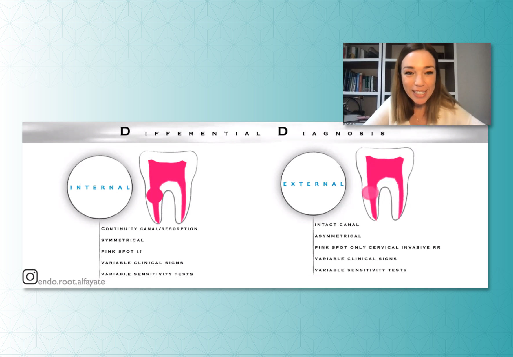 EAP DE ODONTOLOGÍA REALIZÓ VIDEOCONFERENCIA EN COORDINACIÓN CON LA ASOCIACIÓN ESPAÑOLA DE ENDODONCIA