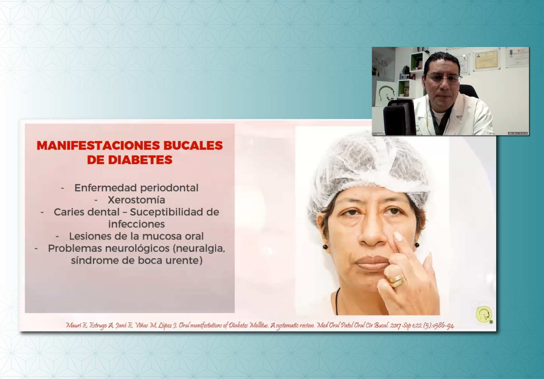 EAP DE ODONTOLÓGIA Y DENTAID ORGANIZARON VIDEOCONFERENCIA SOBRE SALUD BUCAL Y DIABETES